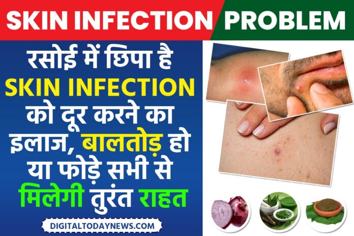 Skin Infection Problem